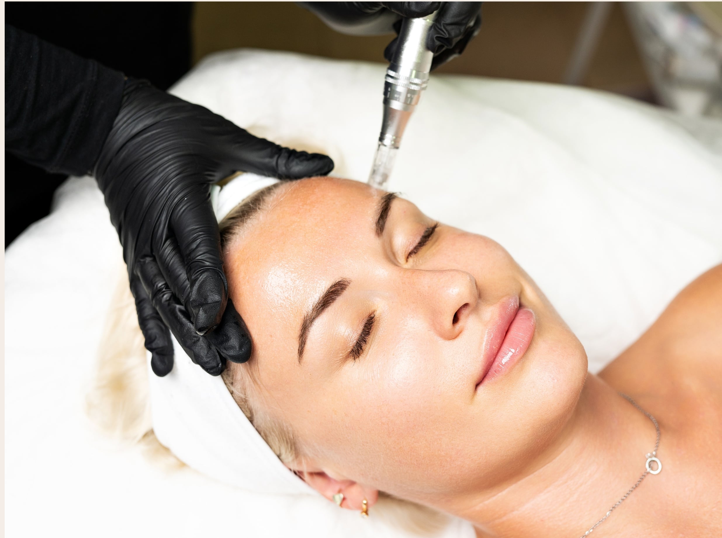 Skin Rejuvenation